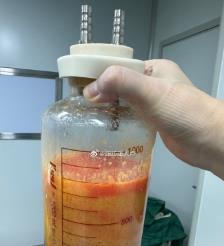 惠东水动力吸脂手术要做多久？